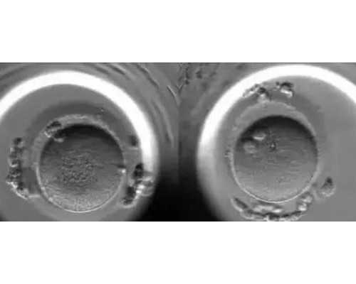 南京代生儿子与试管婴儿技术解析：助孕流程与费用指南