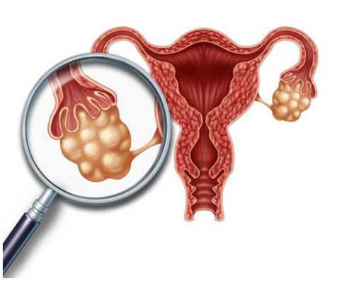 美国试管婴儿的优势与劣势解析：代孕与供卵代怀的考量