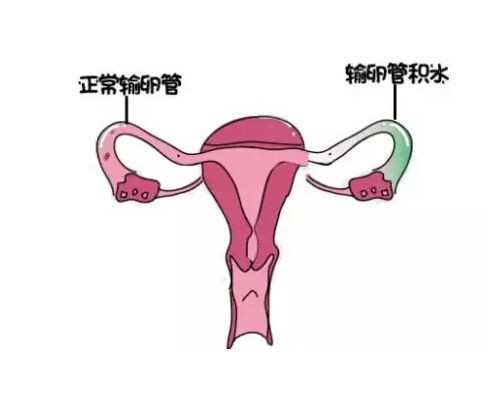 国内私立医院做试管婴儿需要结婚证吗？没有结婚证可以做试管助孕吗？