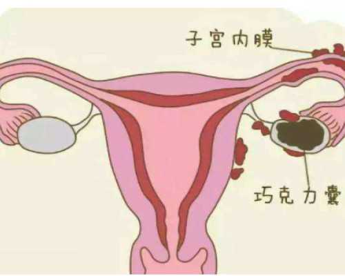 人工受孕与试管婴儿选择指南：哪种助孕方式更适合您