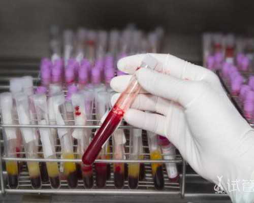 试管婴儿费用解析与成功率指南