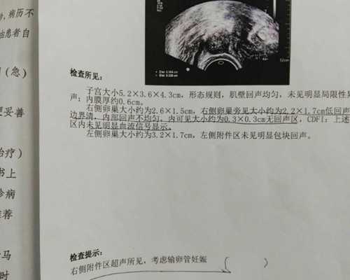 南京权威代生机构解析45岁供卵试管成功率与高龄助孕策略