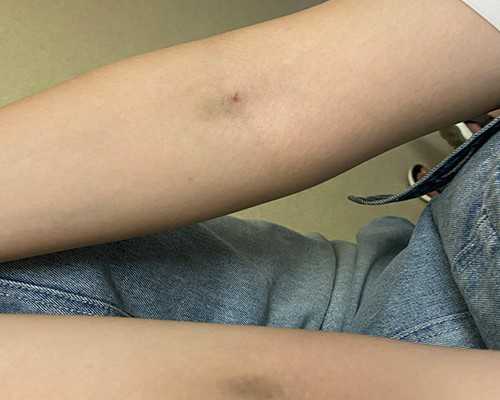 江苏试管婴儿医院实力排名及选择指南