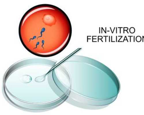 柬埔寨试管婴儿费用解析与供卵代怀指南