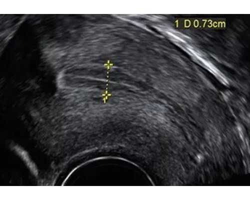 南京供卵代生价钱,三代试管婴儿技术原理是什么？看完这个你就明白了！_做三