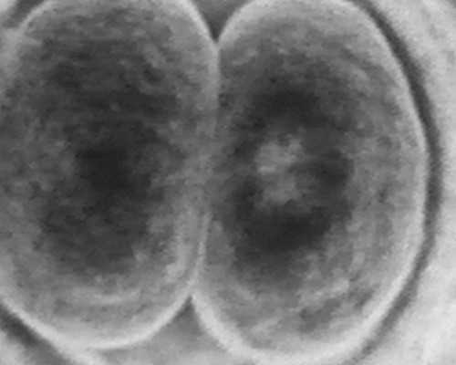 江苏人民医院试管助孕实力解析,专业医生团队与先进技术保障